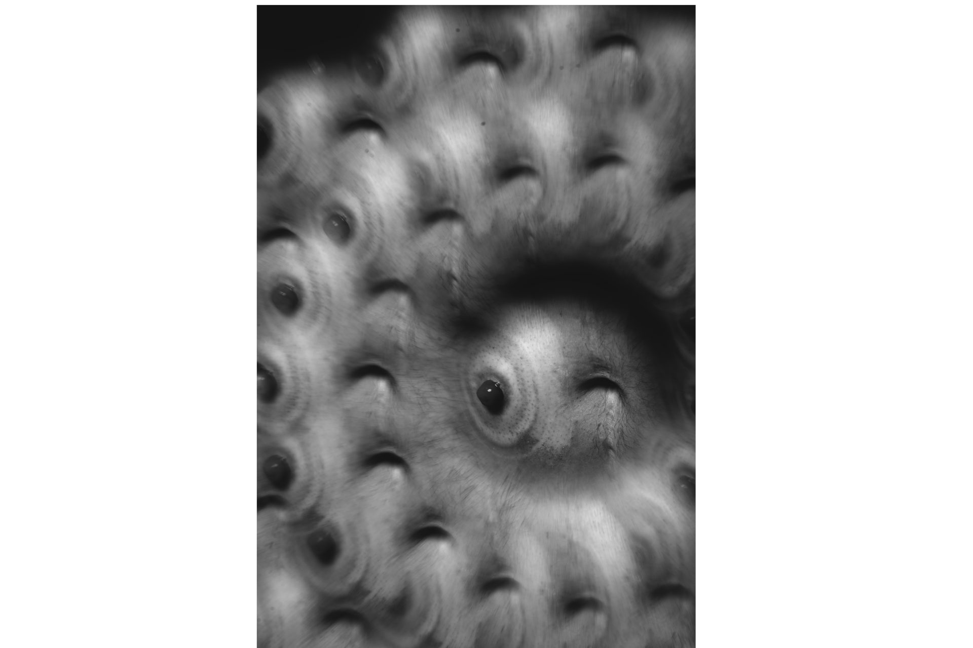 Polypus