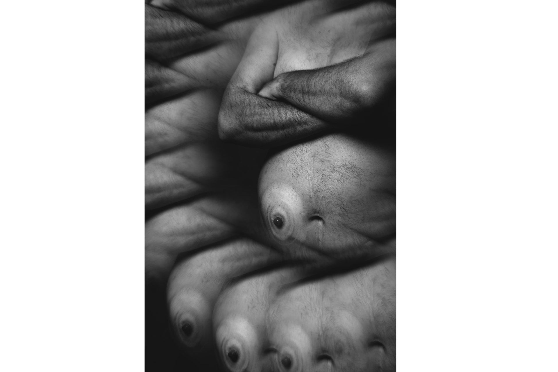 Ileostomia